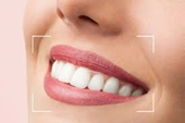 Picture for category Tooth Polisher, Whitening